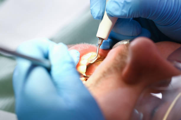 Best Emergency Care for Gum Disease in Atlantic Beach, NY